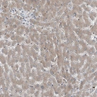 Immunohistochemical staining of human liver shows weak granular cytoplasmic positivity in hepatocytes.