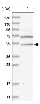 Lane 1: Marker [kDa] 230, 130, 95, 72, 56, 36, 28, 17, 11_br/_Lane 2: Human cell line RT-4
