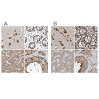 Anti-ERLEC1 Antibody