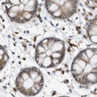 Immunohistochemical staining of human colon using Anti-ERLEC1 antibody HPA031503.