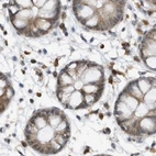 Immunohistochemical staining of human colon using Anti-ERLEC1 antibody HPA031503.