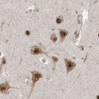 Immunohistochemical staining of human cerebral cortex using Anti-ERLEC1 antibody HPA031503.