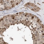 Immunohistochemical staining of human testis using Anti-ERLEC1 antibody HPA031503.
