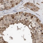 Immunohistochemical staining of human testis using Anti-ERLEC1 antibody HPA031503.