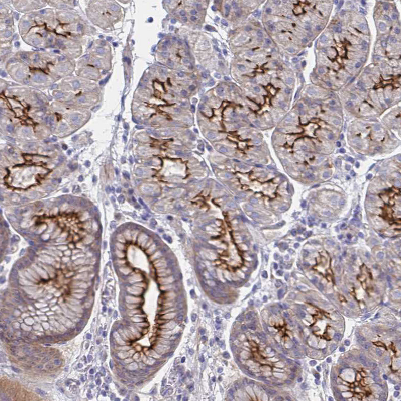 Anti-SSTR1 Antibody