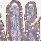 Immunohistochemical staining of human upper gastrointestinal shows moderate to strong positivity in luminal membrane in glandular cells.