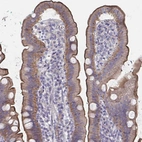 Immunohistochemical staining of human upper gastrointestinal shows moderate to strong positivity in luminal membrane in glandular cells.