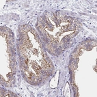 Immunohistochemical staining of human prostate shows moderate to strong positivity in apical membrane in glandular cells.