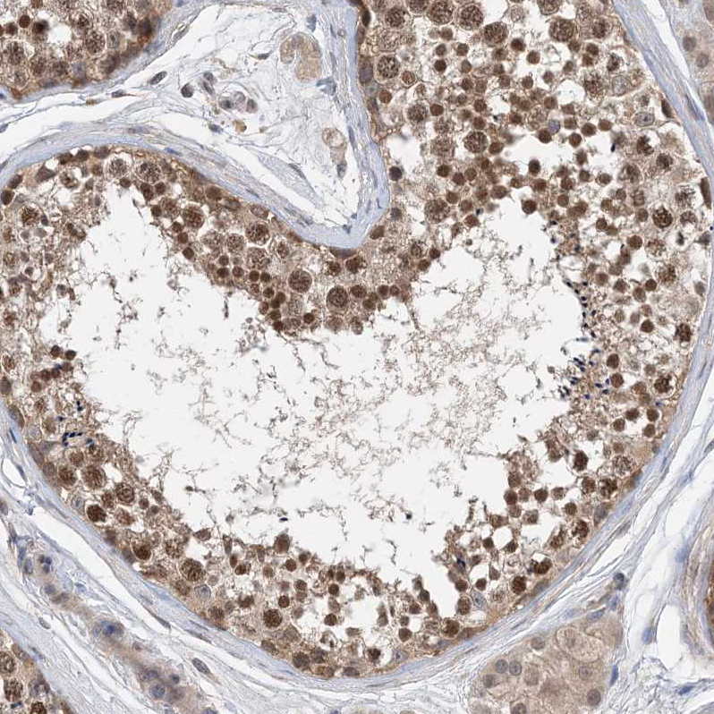 Anti-STK19 Antibody