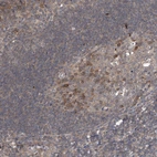 Immunohistochemical staining of human tonsil shows moderate nuclear and cytoplasmic positivity in germinal center cells.