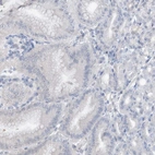 Immunohistochemical staining of human stomach shows no nuclear positivity in glandular cells.