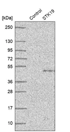 Western blot analysis in control (vector only transfected HEK293T lysate) and STK19 over-expression lysate (Co-expressed with a C-terminal myc-DDK tag (~3.1 kDa) in mammalian HEK293T cells, LY410091).
