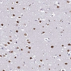 Immunohistochemical staining of human cerebral cortex shows strong nuclear positivity in neurons.