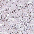 Anti-POLR1A Antibody