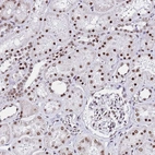 Immunohistochemical staining of human kidney shows strong nuclear positivity in cells in tubules.