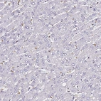 Immunohistochemical staining of human liver shows no positivity in hepatocytes as expected.