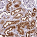 Immunohistochemical staining of human kidney shows moderate membranous positivity in cells in tubules.