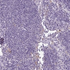 Immunohistochemical staining of human lymph node shows no positivity in non-germinal center cells as expected.