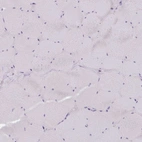 Immunohistochemical staining of human skeletal muscle shows no positivity in myocytes as expected.