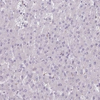 Immunohistochemical staining of human liver shows no positivity in hepatocytes as expected.
