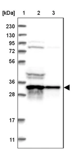 Lane 1: Marker [kDa] 230, 130, 95, 72, 56, 36, 28, 17, 11_br/_Lane 2: Human cell line RT-4_br/_Lane 3: Human cell line U-251MG sp