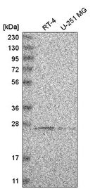 Anti-HSCB Antibody