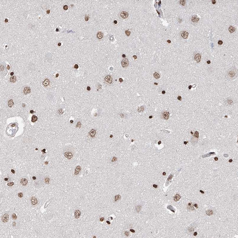 Anti-RP9 Antibody