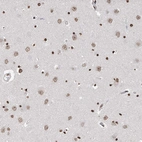 Anti-RP9 Antibody