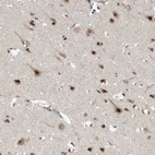 Anti-RPAIN Antibody