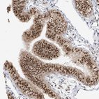 Immunohistochemical staining of human fallopian tube shows strong nuclear positivity in glandular cells.