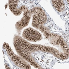 Immunohistochemical staining of human fallopian tube shows strong nuclear positivity in glandular cells.