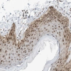 Immunohistochemical staining of human skin shows strong nuclear positivity in squamous epithelial cells.