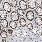 Immunohistochemical staining of human rectum shows strong nuclear positivity in glandular cells.