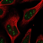 Immunofluorescent staining of human cell line U-2 OS shows localization to nucleus & nucleoli fibrillar center.