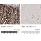 Anti-GMDS Antibody