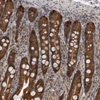 Immunohistochemical staining of human duodenum shows strong cytoplasmic-nucleus positivity in glandular cells.