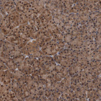 Immunohistochemical staining of human pancreas shows moderate cytoplasmic-nucleus positivity in exocrine glandular cells.