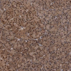 Immunohistochemical staining of human pancreas shows moderate cytoplasmic-nucleus positivity in exocrine glandular cells.