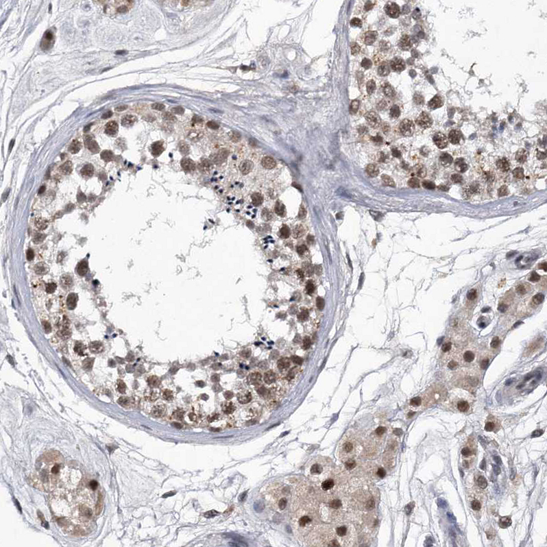 Anti-KIAA1429 Antibody