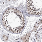 Anti-KIAA1429 Antibody