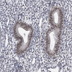 Anti-KIAA1429 Antibody
