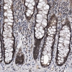 Immunohistochemical staining of human rectum shows moderate nuclear positivity in glandular cells.