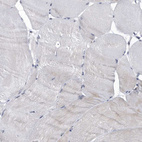 Immunohistochemical staining of human skeletal muscle shows very weak cytoplasmic positivity in myocytes.