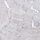 Immunohistochemical staining of human skeletal muscle shows very weak cytoplasmic positivity in myocytes.