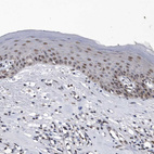 Immunohistochemical staining of human skin shows moderate nuclear positivity in squamous epithelial cells.