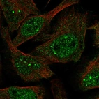 Immunofluorescent staining of human cell line U-2 OS shows localization to nucleoplasm, nuclear bodies & cytosol.