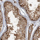 Immunohistochemical staining of human Testis shows strong cytoplasmic and membranous positivity in cells in seminiferous ducts and Leydig cells.
