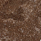 Immunohistochemical staining of human Tonsil shows strong cytoplasmic and membranous positivity in germinal center and non-germinal center cells.