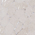Immunohistochemical staining of human Skeletal muscle shows very weak cytoplasmic positivity in myocytes.