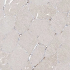 Immunohistochemical staining of human Skeletal muscle shows very weak cytoplasmic positivity in myocytes.